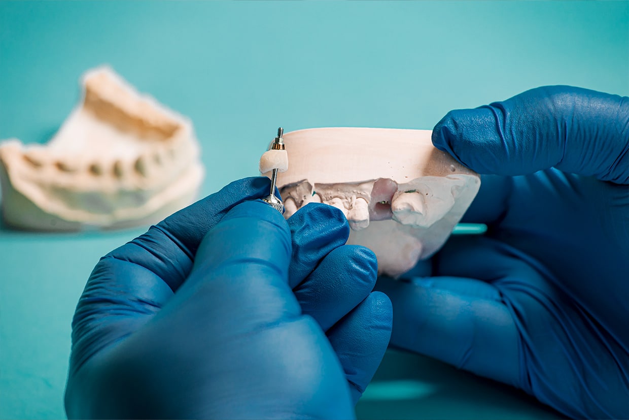 prosthodontie